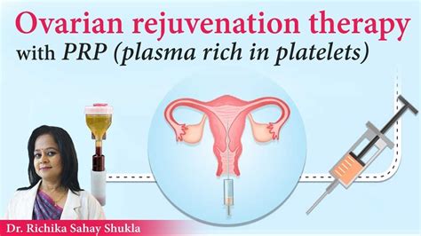 In women with fertility issues PRP is used to thicken the resistant endometrium and revitalise the non-functioning ovaries in an attempt to restore some ovarian function and boost the egg production. . Prp ovarian rejuvenation california